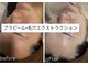 ルネ(Renee)の写真