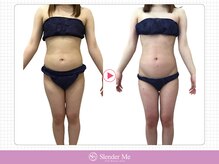 スレンダーミー 甲府本店(Slender Me)/ダイエット実績