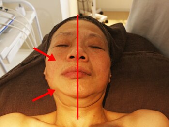 カロンボーテ(Calon beaute)/30・40代以上のエイジングケア☆