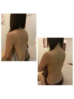 クシェル(kuschel)/美背中でいきましょう!