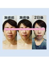 サロンドミジュ(Salon de 美jyu)/小顔・骨格矯正　Y様40代