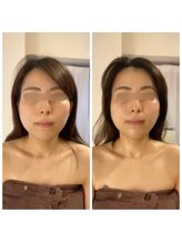 パピヨン(papillon)/ビフォーアフター