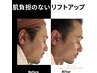 【メンズ】たるみや肌悩み改善＆小顔へ[本格リフトアップコース]¥15,400～