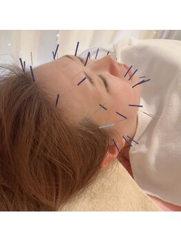 瑞 鍼灸院/オーダーメイド美容鍼