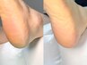 【トータル足裏角質ケア(足裏・踵)】　+【足の爪切りセット】￥8250