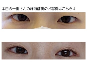 アロマスイーツ(AromaSweets)/まつげパーマ・まつ毛パーマ