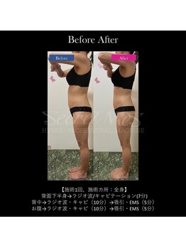 フェレザ 新潟(Felleza)/新潟-痩身エステ-BODYエステ