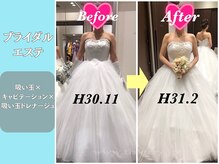 エステティックサロンティエリー/ブライダルエステ１