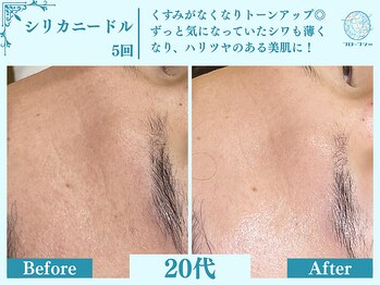 フローフシ∞/【医療機関監修】シワ改善