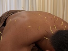 茶ノ木鍼灸整骨院/