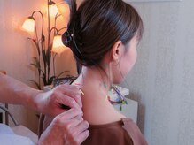 テンジンはり灸院(tenjinはり灸院)/鍼灸施術