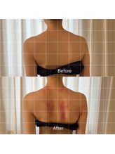 メゾン ド サファリ(maison de Safari)/プレ花嫁さまの駆け込み寺/痩身