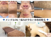 ハピネス 江坂店(Happiness)の雰囲気（1回目から効果実感される方が多く、お客様満足度が高い美肌脱毛）