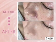 クリアラボ 川崎(Clear Lab)/韓国肌管理&毛穴洗浄専門店