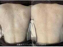 アイル 博多祇園店(iru)/