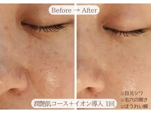 カモラス(CAMOLUS)の雰囲気（潤艶肌を手に入れよう♪イオン導入もすると効果もUP◎毛穴高蔵寺）