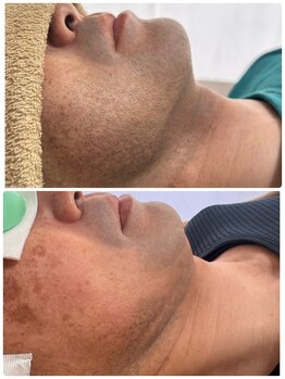 ティアレ 緑井店(Tiare)/