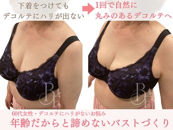 ベルフルール/年齢だからと諦めていた方/熊本