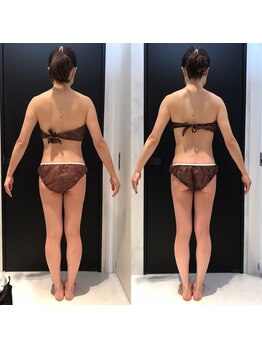 リボディ 表参道(An re Body)/before→after