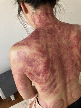 りふ/初回は痛いです…