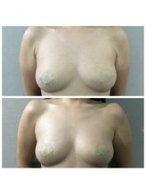 ヴィノ アイサロン(VINNO eyesalon)/ふわふわボリュームアップ♪