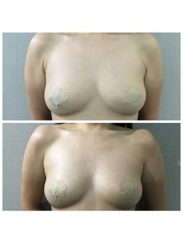 ヴィノ アイサロン(VINNO eyesalon)/ふわふわボリュームアップ♪