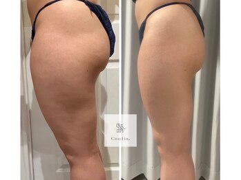 マシェリ 吉祥寺(Macherie)/脂肪燃焼　10ml導入