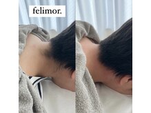 フェリモール(Felimor.)/シュガーリングbefore/after