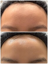 サロン ド ビジュー(salon de bijoux)/お客様フォト