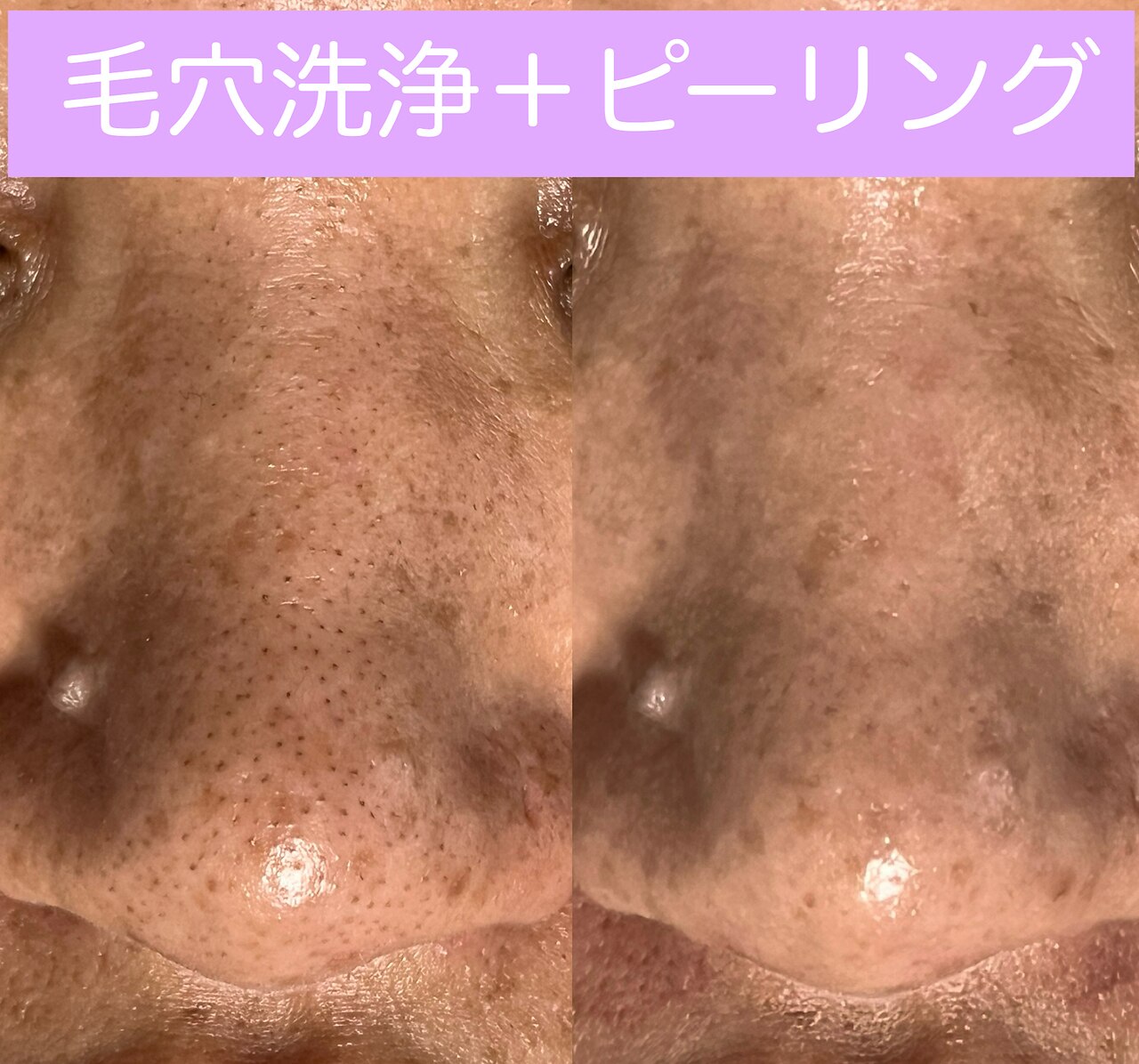 レアマカナ(LeaMakana)｜ホットペッパービューティー