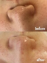 ナチュラ ソース(NatureSouce)/