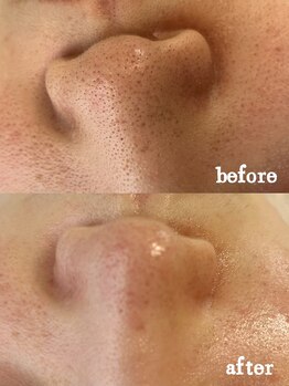 ナチュラ ソース(NatureSouce)/