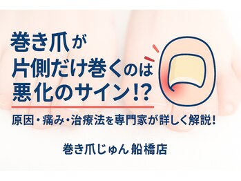 巻き爪じゅん 船橋店/片側だけ巻く片巻きは悪化サイン