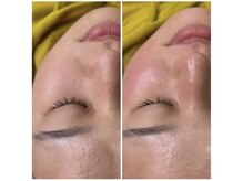 リモレア(RemoLe'a)の雰囲気（【艶肌WAX】産毛古い角質除去スキンケアの浸透率up）