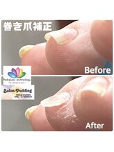 サロンドットプディング(Salon.Pudding)/中度のお客様写真(中指)