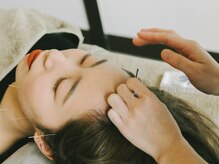 アキュネ 福岡薬院店(acune)/福岡/薬院/美容鍼/美肌