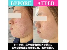 医療提携サロンの雰囲気（無理なく始める！まずはご自分のペースで初めて継続していく♪）