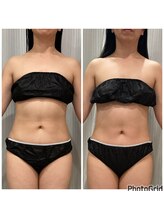 クリスタルミー 横須賀(Crystal me)/お腹特化開発！体感◎お得な3回