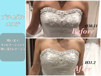 エステティックサロンティエリー/ブライダルエステ２