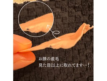 ルミナス(Luminous)/お顔ワックス脱毛