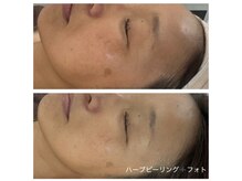 ベラーモ(BELLAMO)