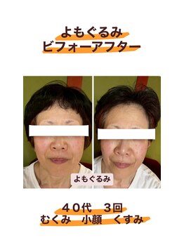 よもぐるみ 桃山台店/ビフォーアフター[よもぎ蒸し]