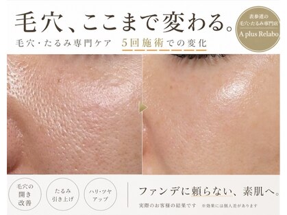 エー プラス リラボ(A plus Relab)の写真