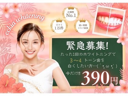 エクシアホワイトニング 天神店の写真