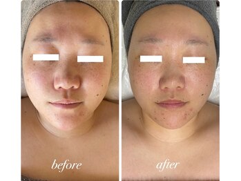 ディアンヌ(Diane)/小顔/二の腕/骨盤矯正/美痩身