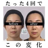 キュープ 鹿児島西陵店(Qpu)