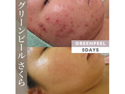 ビューティーメイクさくらの写真