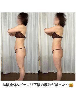 シュシュ エステティックアンドヨガ(chouchou esthetique&yoga)/とりあえず脂肪2時間半コース