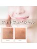 【1回で激変シミケア】光フェイシャル11000円→7700円