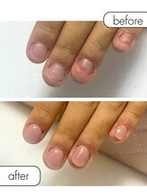 ピノ(pino)/◆深爪矯正＋自爪風仕上げ◆